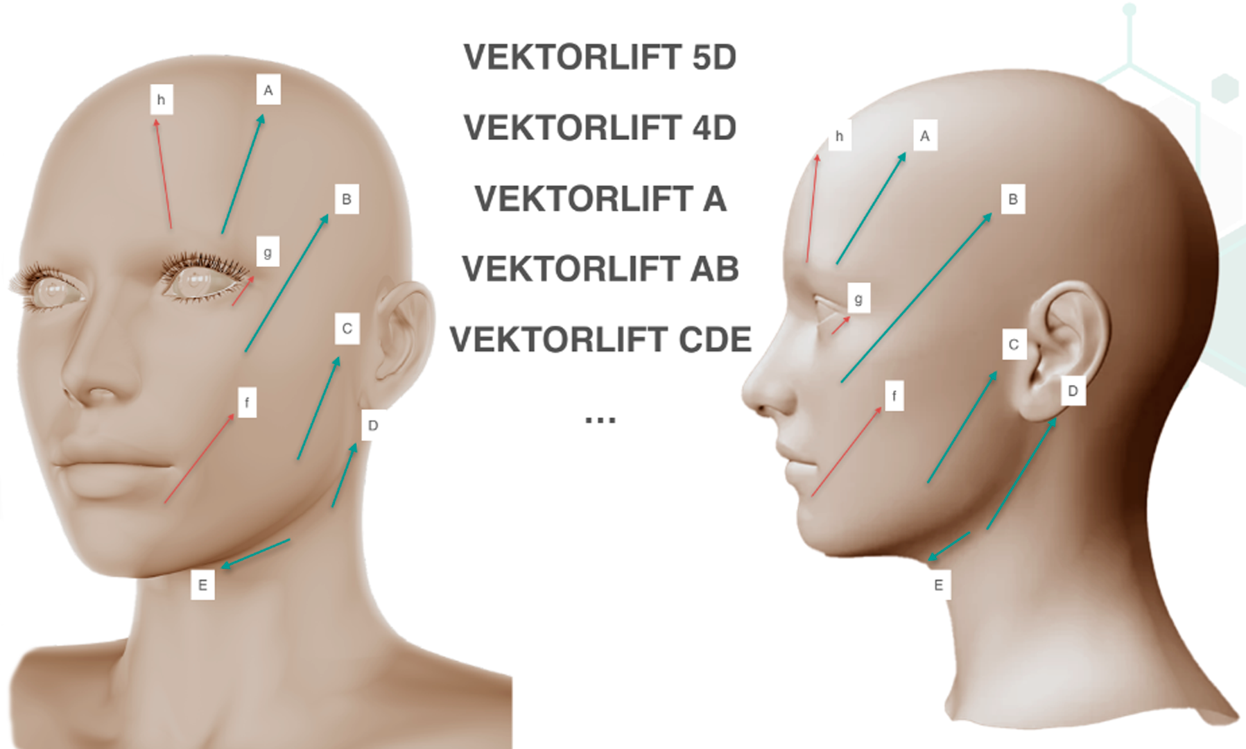 VektorLift - Cirurgia Plástica Facial, Facelift (cirurgia plástica da face) e Necklift (pescoço), técnica que possibilita alta no mesmo dia e rápida recuperação